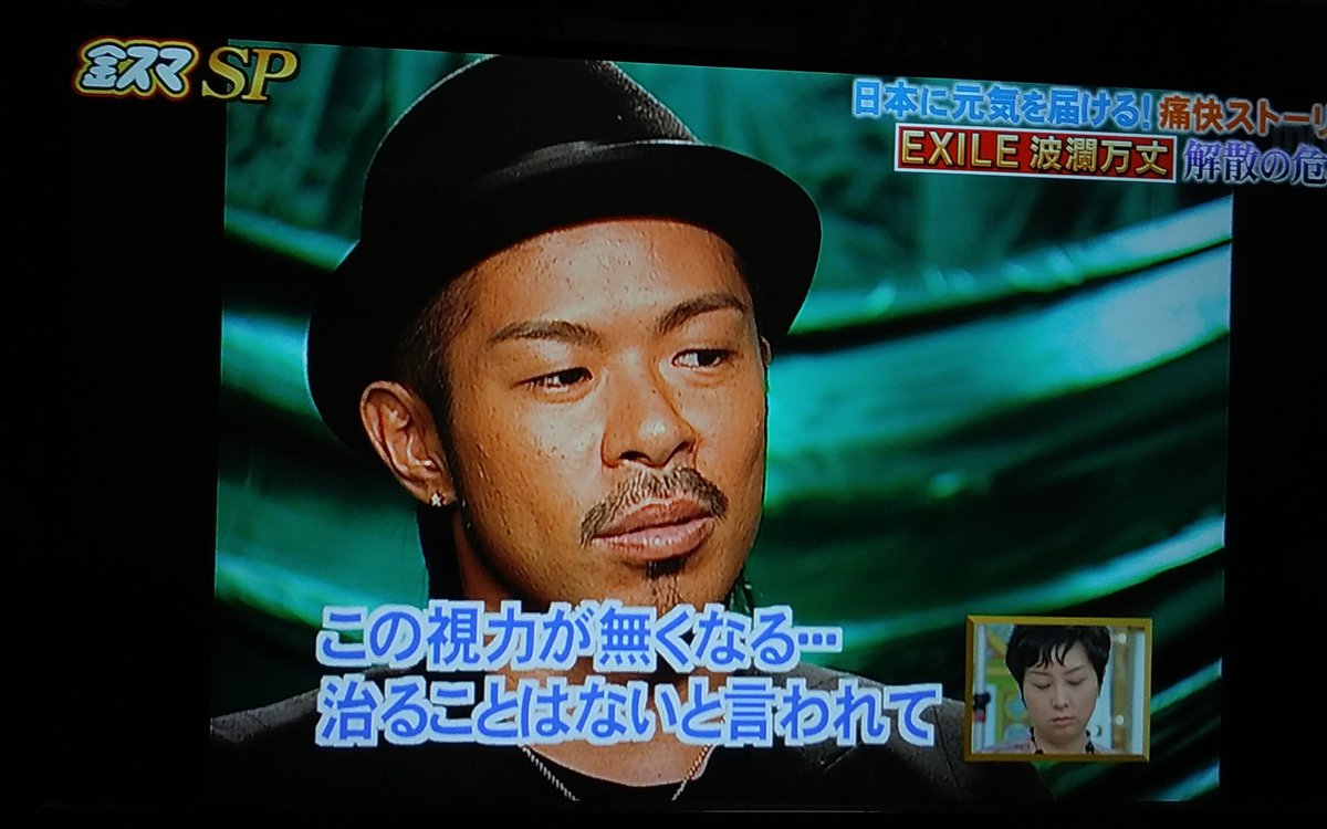 小宮璃央しか勝たん 金スマsp Exile Matsuは左目 病気になって ベーチェット病なんです そして 2人入ってakira Takahiro です