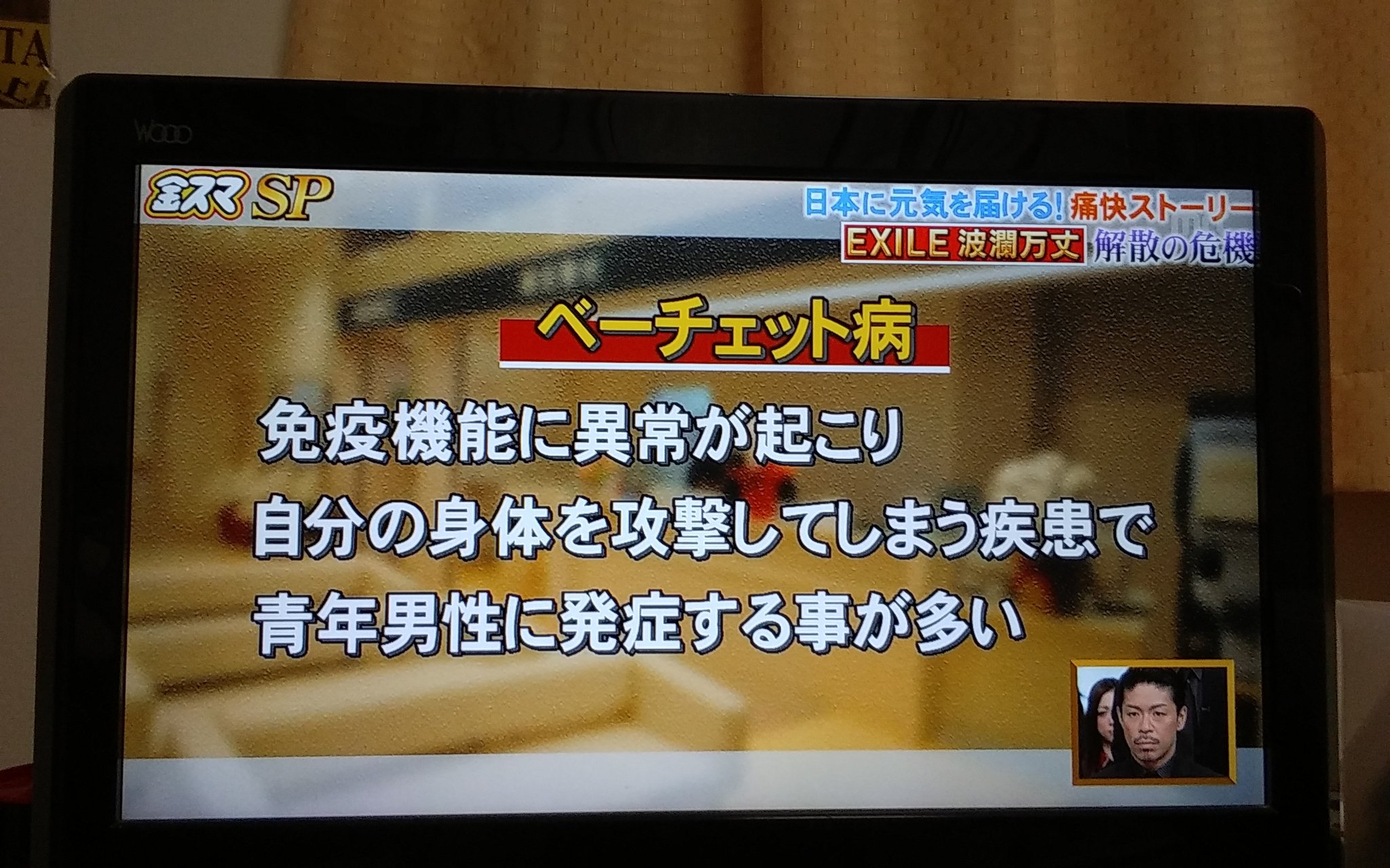 黒木雅子 佐藤健大好きファンです 金スマsp Exile Matsuは左目 病気になって ベーチェット病なんです そして 2人入ってakira Takahiro です T Co Mnma78xmya Twitter