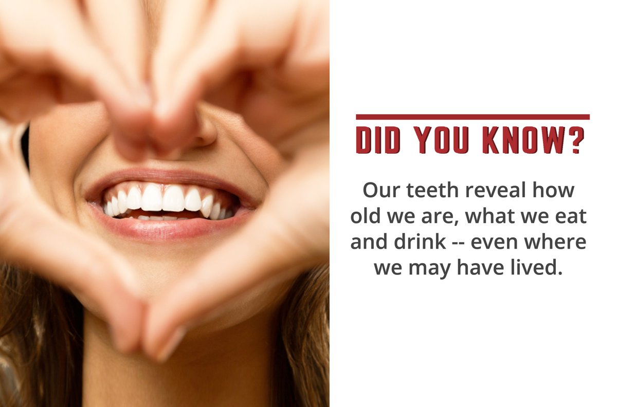 Teeth are like. Teeth are like