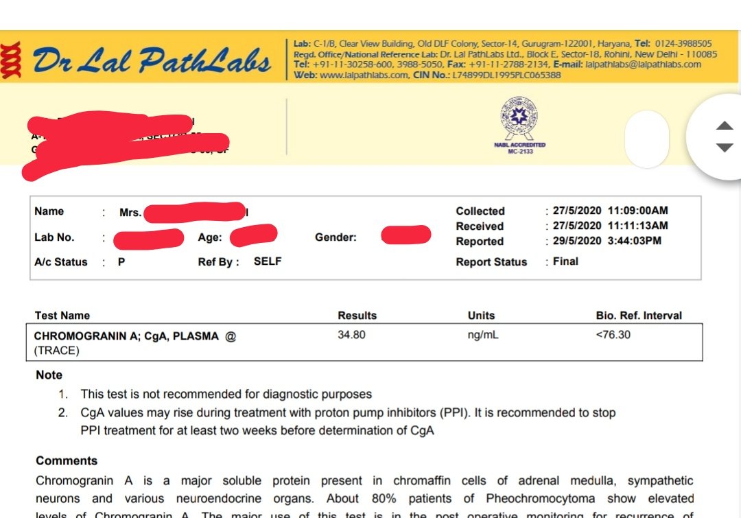 sugandhadureja's tweet photo. A relieved NET patient today whose repeat CgA came normal after holding PPIs. Often missed, but important cause of false positives. Glad to have averted a cascade of unnecessary investigations and anxiety. #smallwins #NeuroendocrineTumor
#NETNuggets https://t.co/dldKmwLxvh