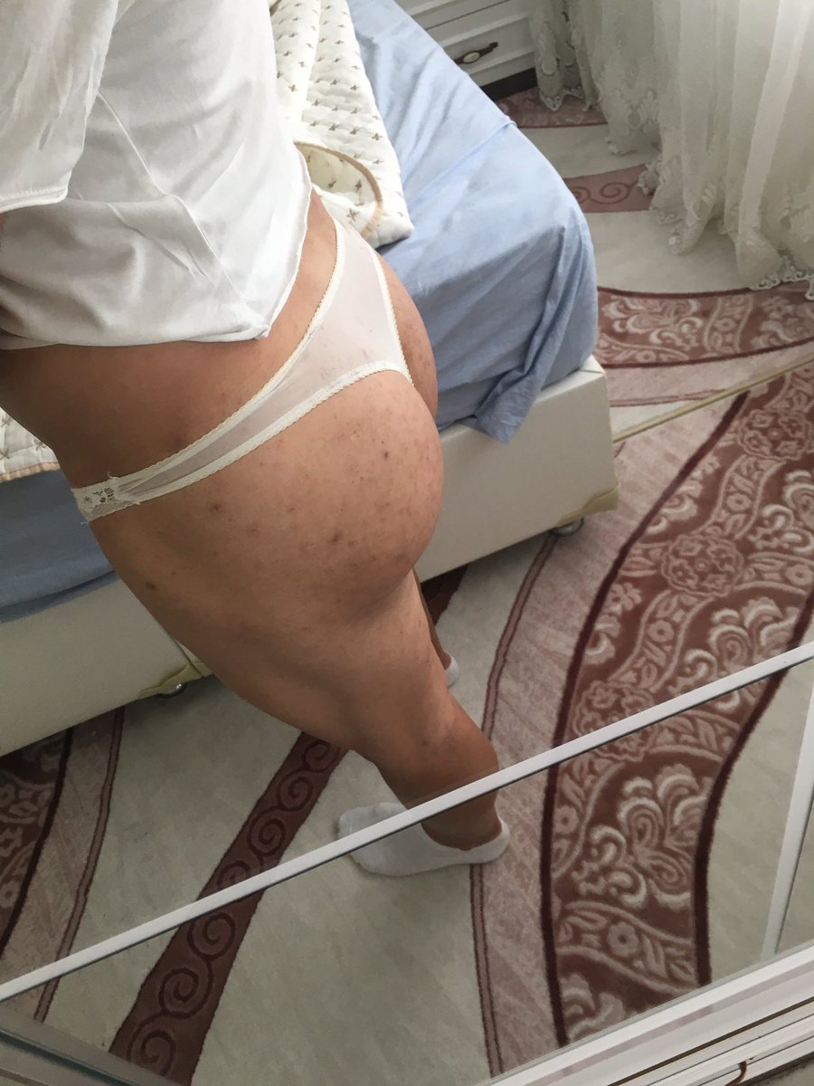 Canım istoyor💋💋💋💋🥰🥰🥰