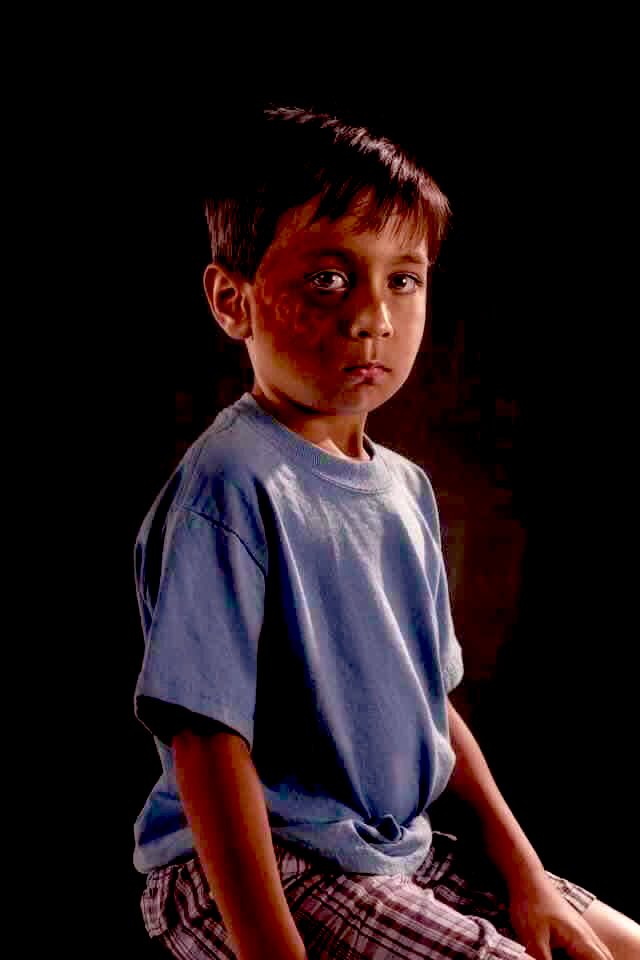 ماذا لو كان تاثير الكلمات يظهر كجروح ؟