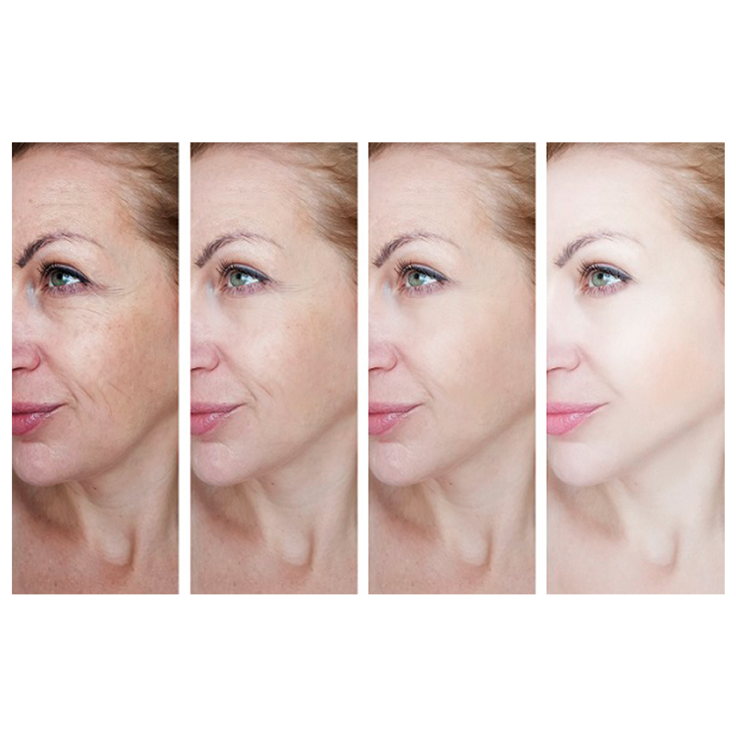 drplacik's tweet photo. Say goodbye to frown lines and crows feet! Botox works on relaxing your facial muscles, smoothing skin, and erasing moderate to severe lines and wrinkles. https://t.co/OSMRK2vGLS