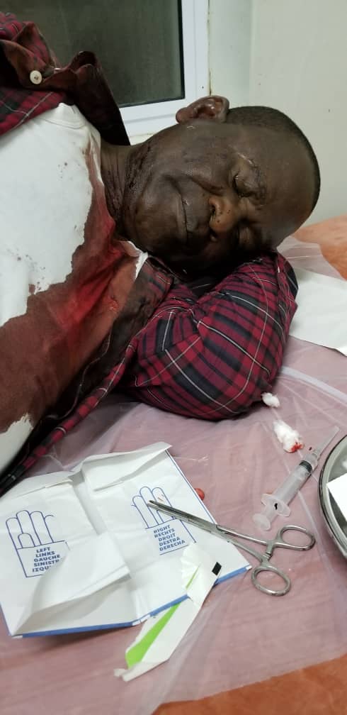 akefegift's tweet photo. Media Driver on the Malawi's Veep convoy that was stonned by DPP and UDF thugs yesterday in Phalombe

For more: 

Vinjeru Ngwira
Online Reporter
O888333814/0995000036 vinjerungwira@gmail.com

@SKChilima @BBCAfrica @misamalawi @amizere @AtupeleMuluziMP @LAZARUSCHAKWERA https://t.co/54C0jryIMr