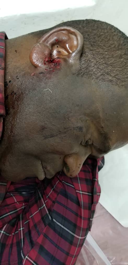 akefegift's tweet photo. Media Driver on the Malawi's Veep convoy that was stonned by DPP and UDF thugs yesterday in Phalombe

For more: 

Vinjeru Ngwira
Online Reporter
O888333814/0995000036 vinjerungwira@gmail.com

@SKChilima @BBCAfrica @misamalawi @amizere @AtupeleMuluziMP @LAZARUSCHAKWERA https://t.co/54C0jryIMr