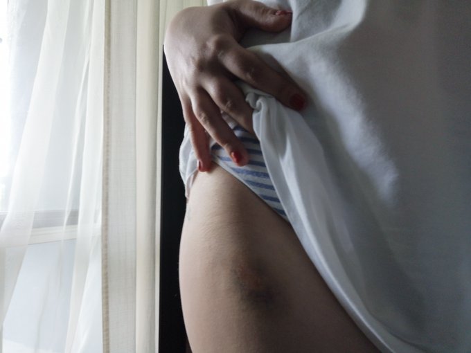 Well hey there, I'm sort of back from my hiatus and here to tell you to subscribe to my https://t.co/qftHnOTnss<a href="/tag/lace"class="tags"><span>#lace</span></a><a href="/tag/sexy"class="tags"><span>#sexy</span></a><a href="/tag/nude"class="tags"><span>#nude</span></a><a href="/tag/thong"class="tags"><span>#thong</span></a><a href="/tag/adult"class="tags"><span>#adult</span></a><a href="/tag/adultwork"class="tags"><span>#adultwork</span></a><a href="/tag/nsfw"class="tags"><span>#nsfw</span></a>