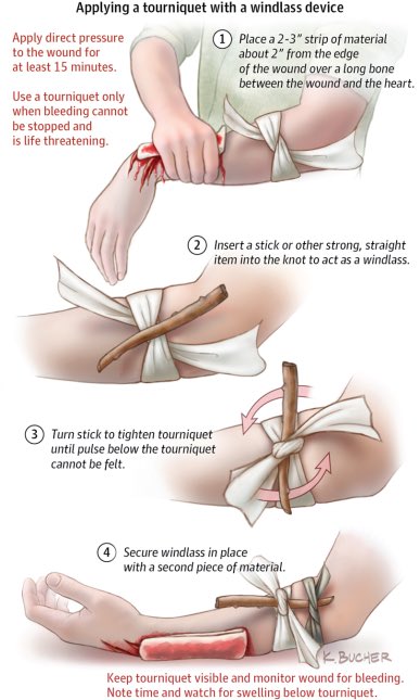 10. They are in order of most urgent to less. If the bleeding is occurring in an extremity, use a bandage of piece of clothing to wrap around ABOVE the injury, NEVER below it. Here’s an easy way to make a tourniquete.