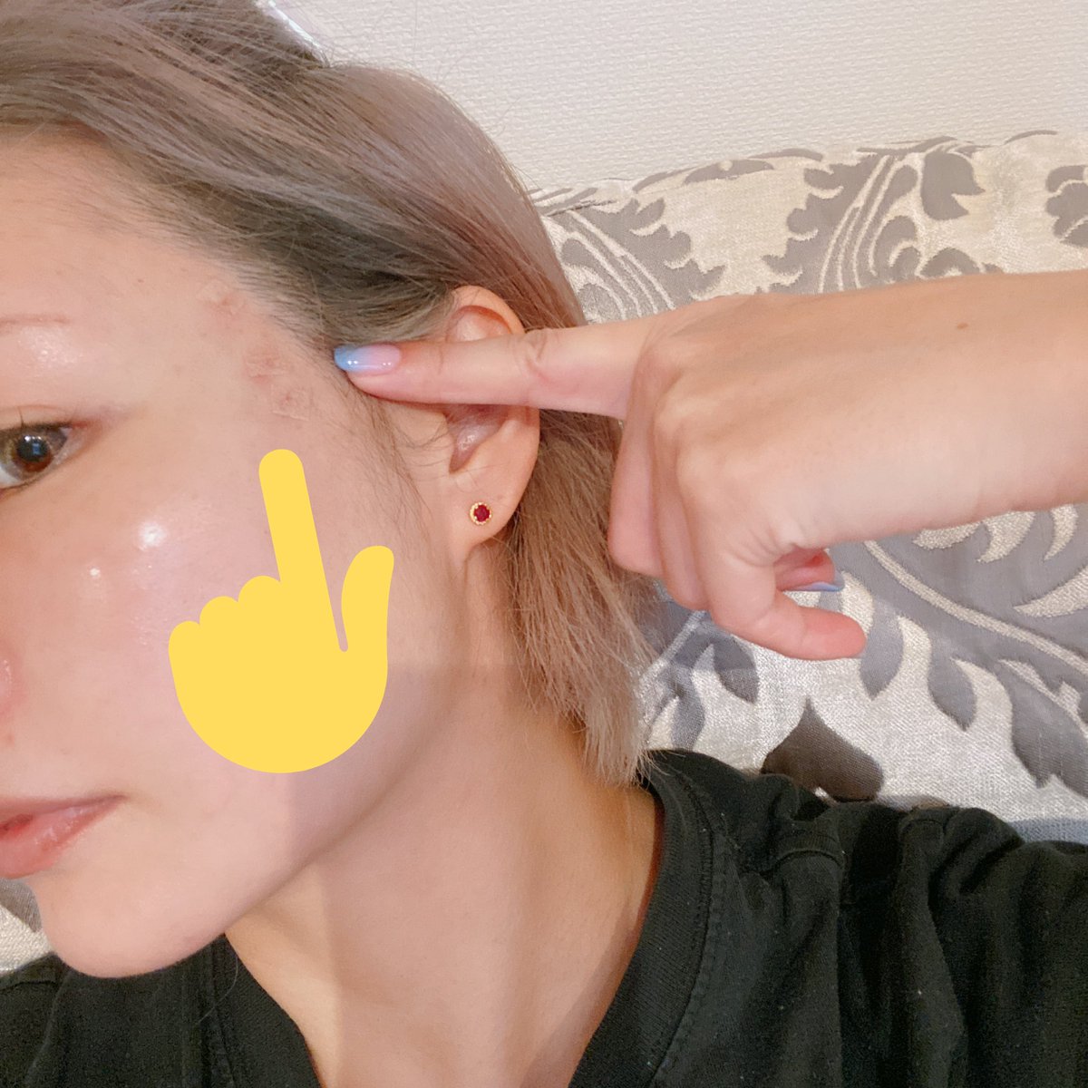 笹本真理子 レチノールフリーでエイジングケアに挑む 私は今となってはhifuの方が痛いです 吸気麻酔もあるって言ってましたよー