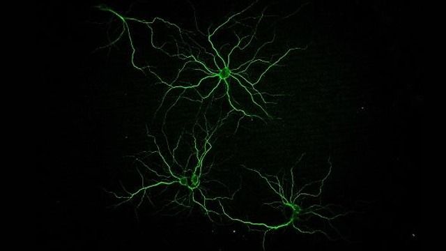 DemCareProds's tweet image. Marine Molecules With Therapeutic Potential Against Alzheimer&apos;s Disease buff.ly/3deBMMJ