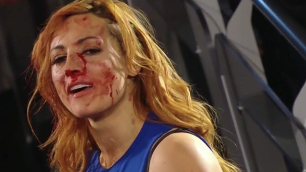 Day 19 of missing Becky Lynch from our screens!