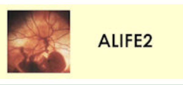 Happy news: we have seen a boost in randomizations in the <a href="/ALIFE2trial/">ALIFE 2</a>. Women with recurrent #miscarriage and #thrombophilia are allocated to #LMWH or standard of care. Lots of new #pregnancies and hope after lockdown 🥰 alife2study.org <a href="/INVENT_VTE/">INVENT-VTE</a>