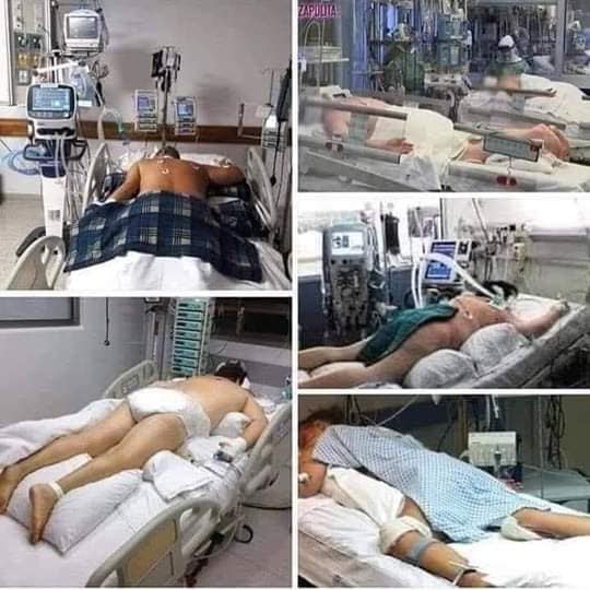 MARIANONIN1's tweet photo. El peligro de COVID-19
Hablan de respiración o ventilación artificial, pero hay muchas personas que no tienen idea de qué se trata. No es una máscara de oxígeno que se pone en la boca mientras uno se acuesta pensando en su vida.  (hilo) https://t.co/NQ52oSe2lh