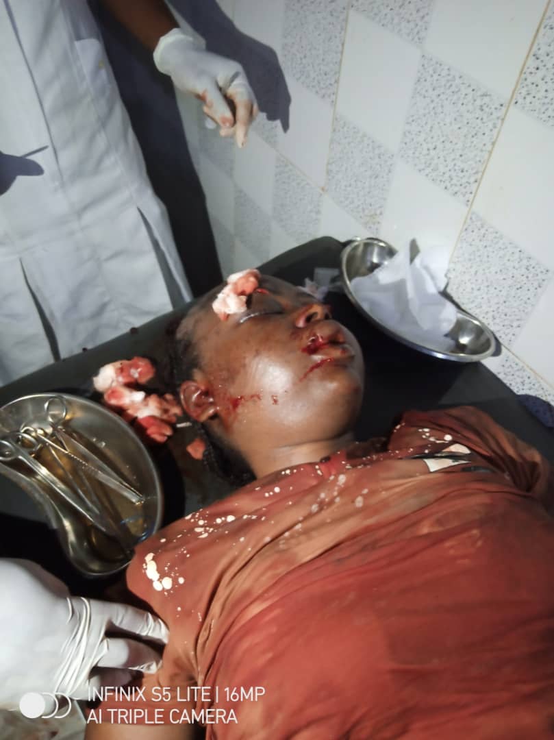 omonzojie's tweet photo. #justice4UWA
End rape now!!!
Raped,brutalized, thought the church is safest place, but was raped right inside the church in benin..fire extinguisher used as assault object on 22yrs old Uwa...Help get justice..@segalink @PoliceNG @PoliceNG_CRU @MirabelCentreNG https://t.co/SZnKbhsvME