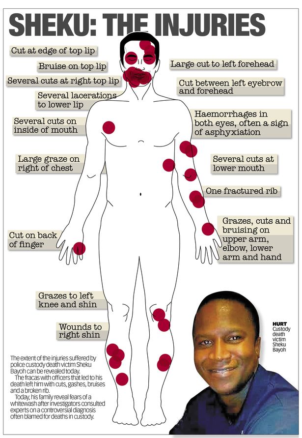 They beat him to death and then they got away with it completely. Five full years on, there is still no justice for Sheku Bayoh.