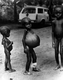 As tough as things were, I now realise I was lucky. Most children around me had protruding stomachs as kwashiorkor took its toll on them, and death was common. If the hunger or bombs didn’t get you, the snakes did. But I was spared the sight of corpses. 20/