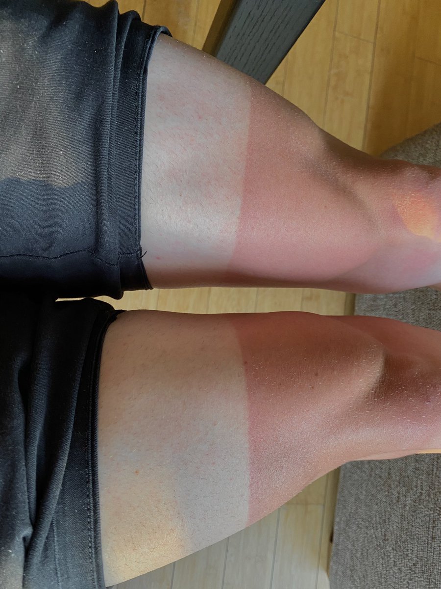 _davidrfoster's tweet image. #cyclistproblems