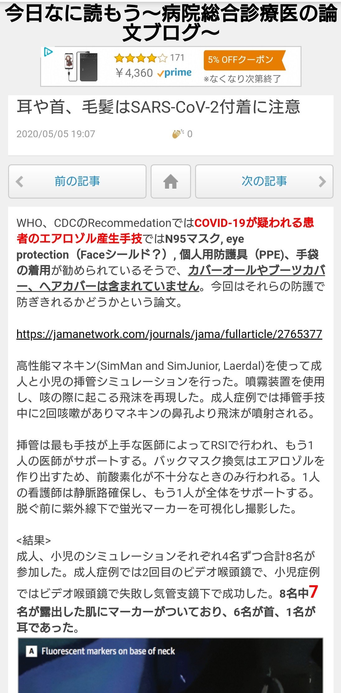 しんちゃん On Twitter Lt 結果 Gt 成人 小児のシミュレーションそれぞれ4名ずつ合計8名が参加した 成人症例では2回目のビデオ喉頭鏡で 小児症例ではビデオ喉頭鏡で失敗し気管支鏡下で成功した 8名中7名が露出した肌にマーカーがついており 6名が首 1名が耳で