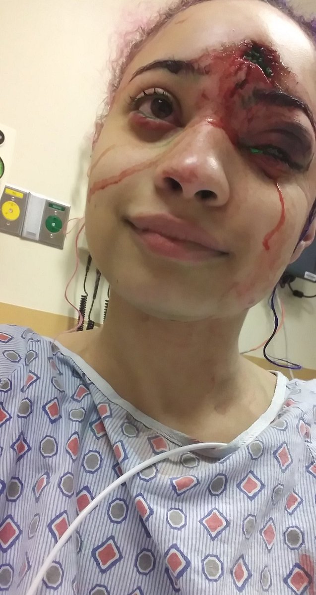 Niakeii's tweet photo. What happen to FUCKING PROTOCOL!!!! You hit the arm or the leg with rubber bullets NOT TAKE FUCKING HEADSHOTS PUSSY #FUCK12 #riots2020 https://t.co/JMVnuaziMj