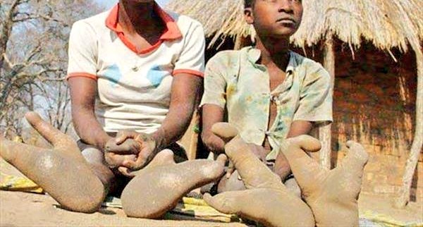 THE OSTRICH PEOPLE OF THE DOMA TRIBE, ZIMBABWE  They only have two toes on each foot.So their feet are V-shaped, like those of an ostrich