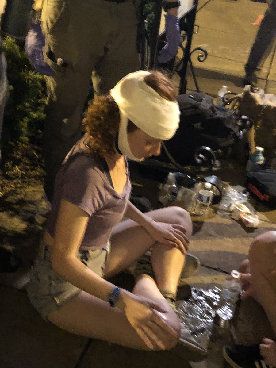 A very small minority (like 5% of the people here) at the  #dcprotest are throwing things at the police. I’ve seen firecrackers, water bottles, and bricks. People who aren’t police are getting hurt.Josie Williams, 19, of DC got hit in the back of the head by a brick.