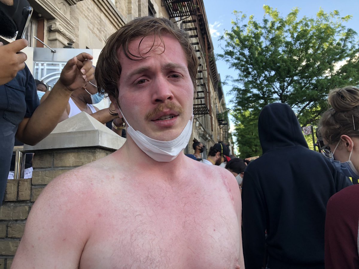 James ojalvo, 27, was pepper sprayed. he says crowd was walking peacefully down the street when police stepped in and shoved them off the street with pepper sprAy and batons. “I’m from Minnesota I had to do something,” he said.