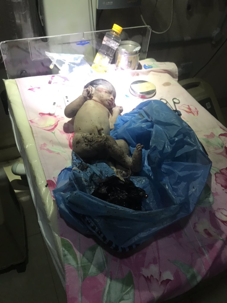 This life is just a pot of beans. Just less than an hour ago a police car drove into the hospital, said they found a baby in in a refuse dump crying so they decided to bring it to the hospital in the boot of their car 
