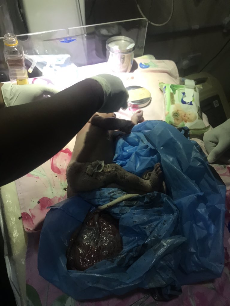 This life is just a pot of beans. Just less than an hour ago a police car drove into the hospital, said they found a baby in in a refuse dump crying so they decided to bring it to the hospital in the boot of their car 