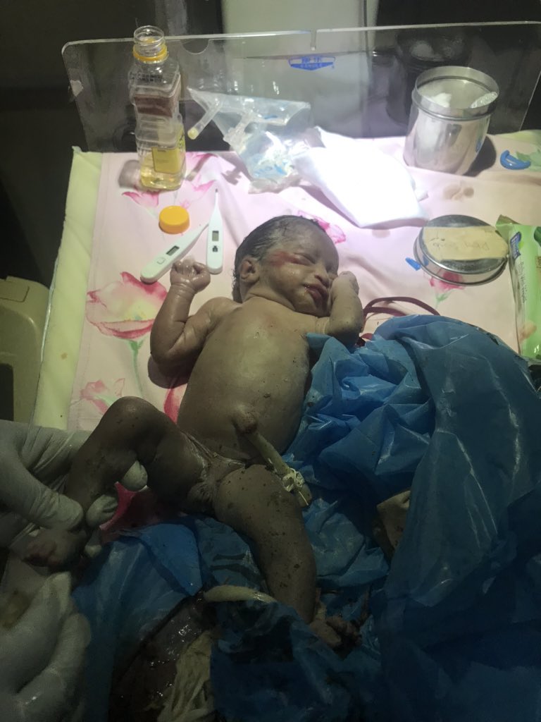 This life is just a pot of beans. Just less than an hour ago a police car drove into the hospital, said they found a baby in in a refuse dump crying so they decided to bring it to the hospital in the boot of their car 