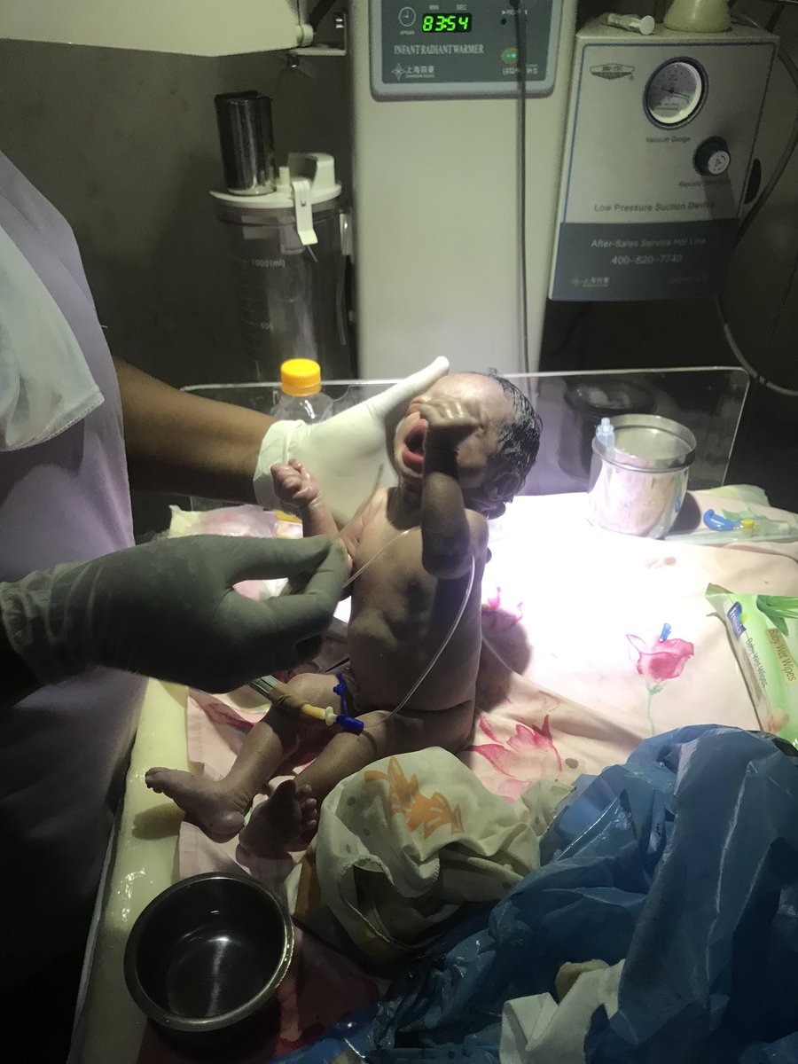 We finally finished resuscitating her... body temperature was back to normal and baby girl is doing well. . . I’ve personally decided to bear the cost of her hospital care until or unless social welfare decides to take her up. I really feel like adopting her Such a fine baby