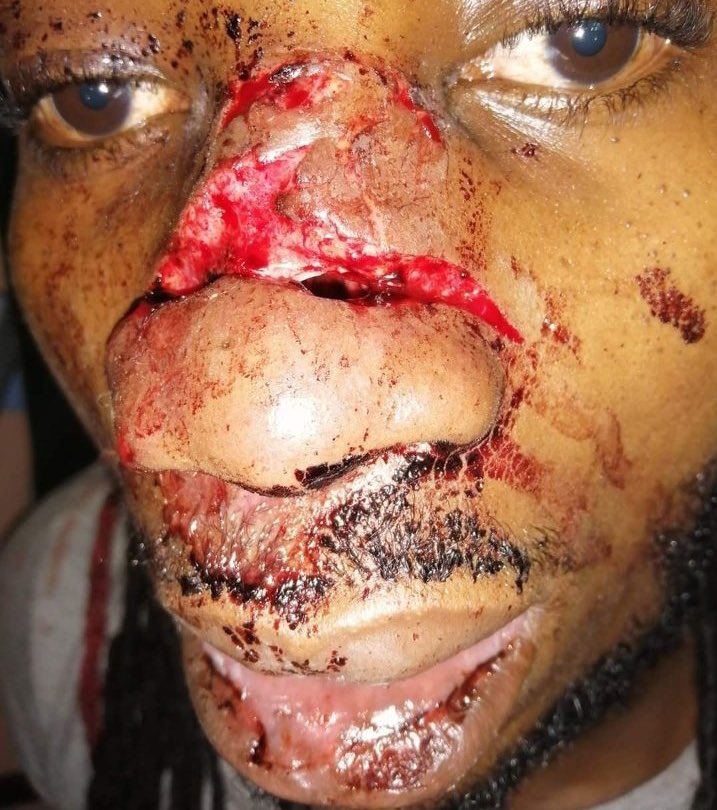 OsamaOtero's tweet photo. Think about this.
Think about the unreported cases.
This is just but one of the many.
If we keep silent we will keep tweeting something like this every year.
Just think about it.

#JusticeForSamuelMaina https://t.co/t5iKKTQ1Gs