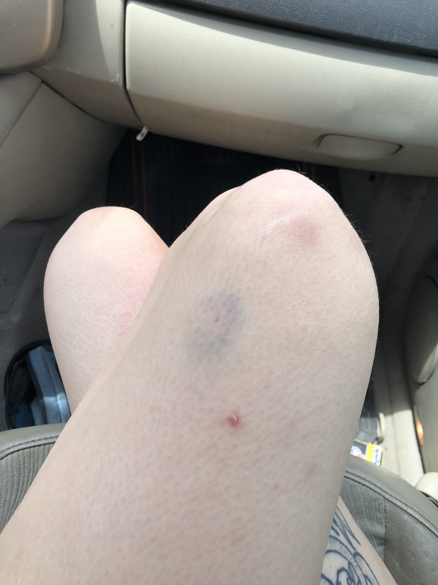 nadie:
absolutamente nadie: 
yo: