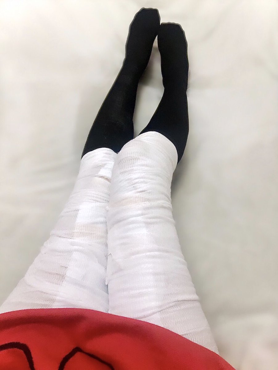 相田 美優 私も下肢静脈瘤みたいで デコボコしてないんだけどクモの巣状の毛細血管みたいなのが浮いてるの ここの病院行ってみる