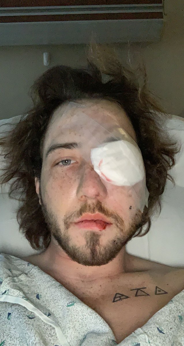 fresh out of post op. I might have to have surgery for broken bones in my face within weeks to come but for now all that happened is I did end up losing my eye. This pales in comparison to the hardships aftican americans have endured for decades. Stand up for what u believe in.