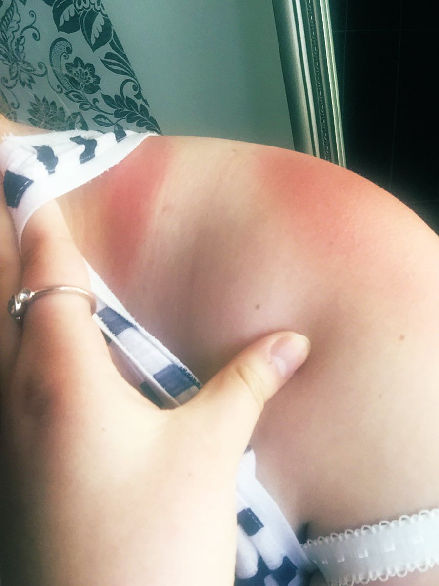 Ich würde sagen, der Sommer ist angekommen. Genießt das schöne Wetter an diesem langen Wochenende, aber denkt an die Sonnencreme! ☀️😄❤️