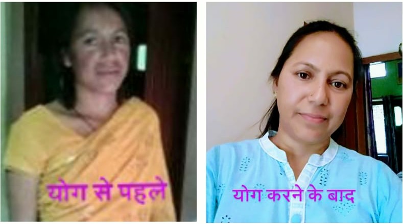 ॐ पूज्य स्वामी जी के सानिध्य में 2012 से निरन्तर योग करने से हुई पूरी काया परिवर्तन👍 पूज्य गुरुदेव को कोटि कोटि नमन 
#महिलापतंजलिउत्तराखंड 
<a href="/yogrishiramdev/">स्वामी रामदेव</a> <a href="/Ach_Balkrishna/">Acharya Balkrishna</a> <a href="/Sadhvi_Devpriya/">Dr. Sadhvi Devpriya</a> <a href="/rakesh_bstpyp/">भारत</a> 
<a href="/PMOIndia/">PMO India</a>