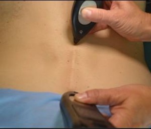 PainExpertKelly's tweet photo. MPS applies a low electric current non-invasively over the skin of key acupuncture and trigger points to duplicate the pain-relieving and cellular changing benefits of acupuncture. 

https://t.co/MtDQtCggfL https://t.co/zJ1LWQadlv