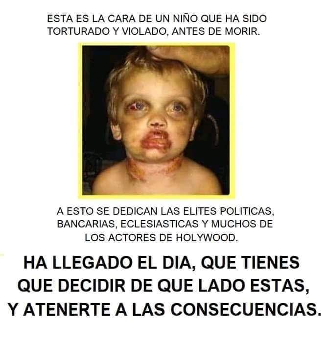 Fernand43087234's tweet photo. Son fuertes fotos pero tu sabes de que lado hacerte #Anonymous 

#Violador @realDonaldTrump https://t.co/hEyvClb3Lq