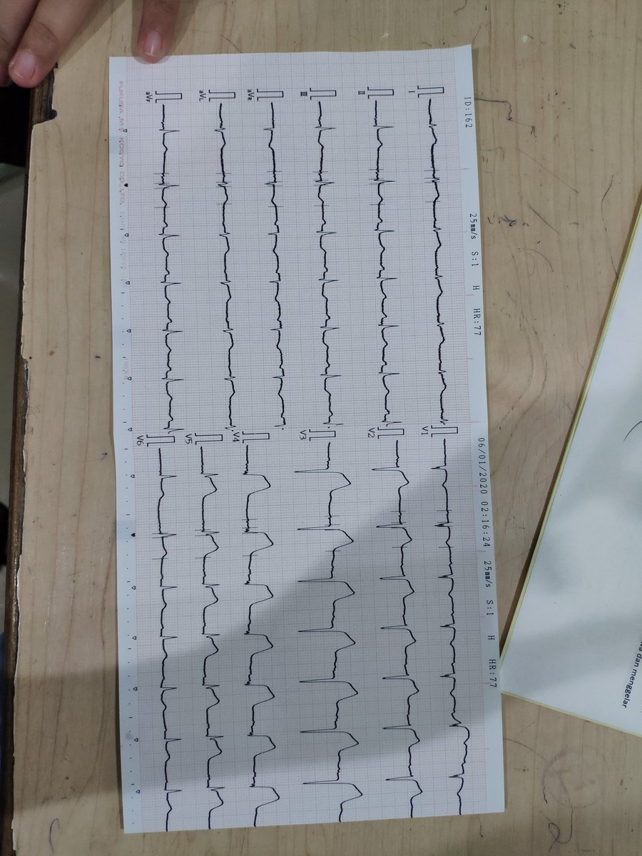 RizalllMS's tweet photo. Udah jelasin panjang lebar, keluarga ps mau pulang 🚑🚑🚑🚑 https://t.co/zyeiYuGm4j