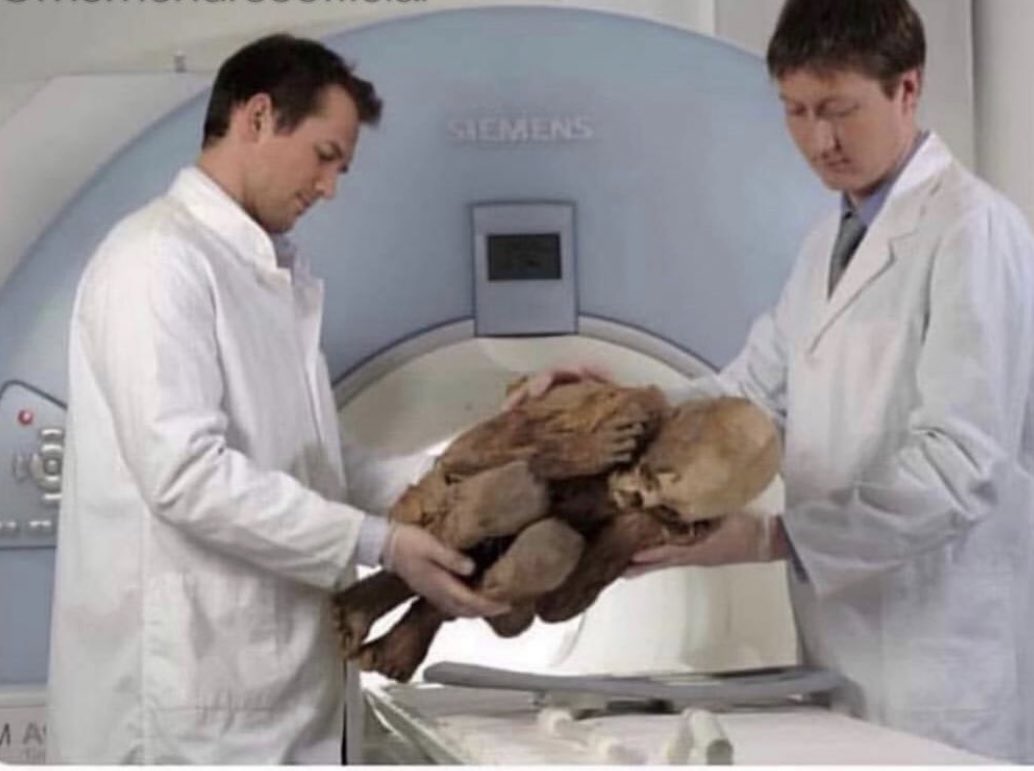 DrGolfShirt's tweet image. Medicine resident: We have a 1200 year old mummified corpse who needs a CT abdo for a slightly elevated lactate... 

Radiology: What’s their eGFR?