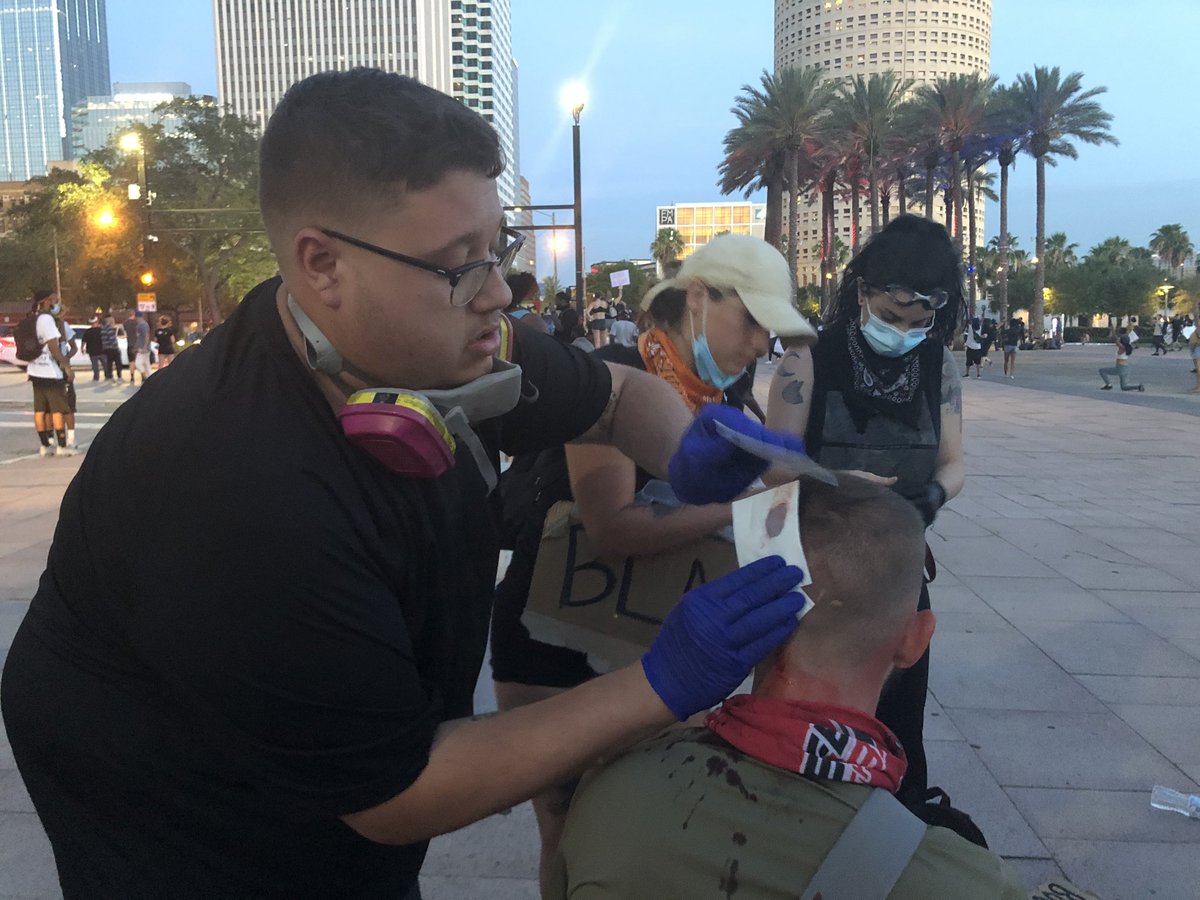 Jordan Coury, 24 was hit with a rubber bullet in the head. The front of his shirt is soaked in blood. Jakob Cuomo, 22, is holding gauze on the wound and called 911. 

The dispatcher, on speaker phone, noted there’s already police on scene. “The police are the ones that shot him!”