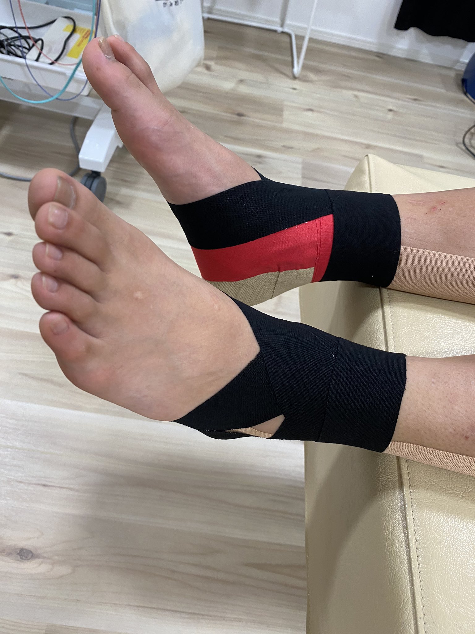 Twitter এ かみおか接骨院 中学1年生サッカー部の学生 足首捻挫とアキレス腱の炎症です テーピングで患部の固定をし安定させることで 痛みを軽減 早期回復を促します 先日より サッカー 野球 バスケ バレー 陸上とスポーツをしている学生がたくさんきて