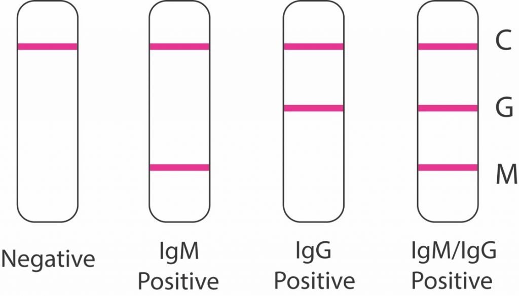 COVID19 antibody test ge natheejaa aisdhaane gothakee baleege kuree kolhu IgM positive vefa balijehi rangalhuvumun IgG positive vun, noonee IgM ,IgG dheythives positive vun adhi dheythives  negetive vun , migothah test hadhanee rapid test kit thakun Pic:Biomedomics