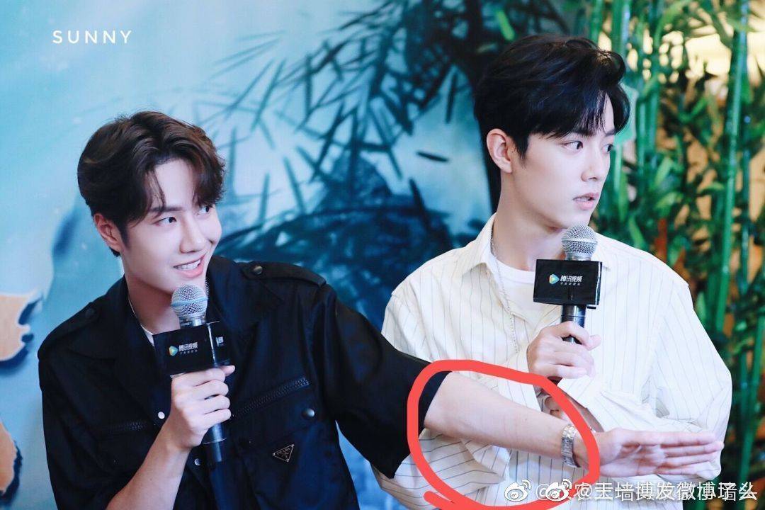 CPNThe scratch mark:Dd had scratch marks on his left hand. Gg had (finger) bruise on his right hand.Sorry didnt have the pic for gg. 