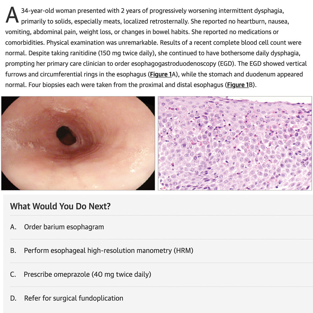 UTHSCPAprogram's tweet image. Thoughts?

#MondaysWithMaday #PAProfPearls #questionoftheday #PAschool #physicianassistant #physicianassistantstudent

Answer - Friday via JAMA