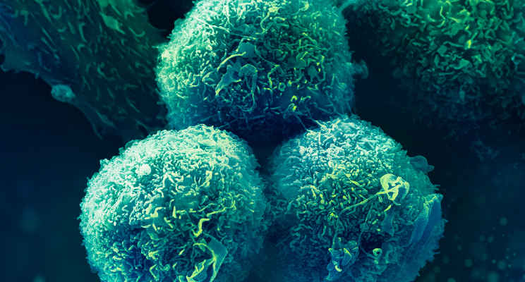 I strongly believe that a joint focus on patient access is needed now maybe more than ever. Cancer patients don’t have the time to wait for this #COVID19 pandemic to end, they rely on progress in #cancer care now. bit.ly/2XSx2WI