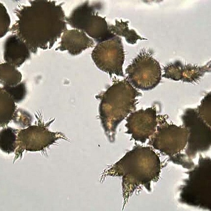 Medschool MCQ 16:
Identify these crystals present in urine:
a) Hippuric acid crystals
b) Triphosphate crystals
c) Calcium carbonate crystals
d) Ammonium biurate crystals

#Pathology #Pathologymcq #medschoolmcq #MedicalStudents #medicina #MedStudentTwitter #Medford #pathology