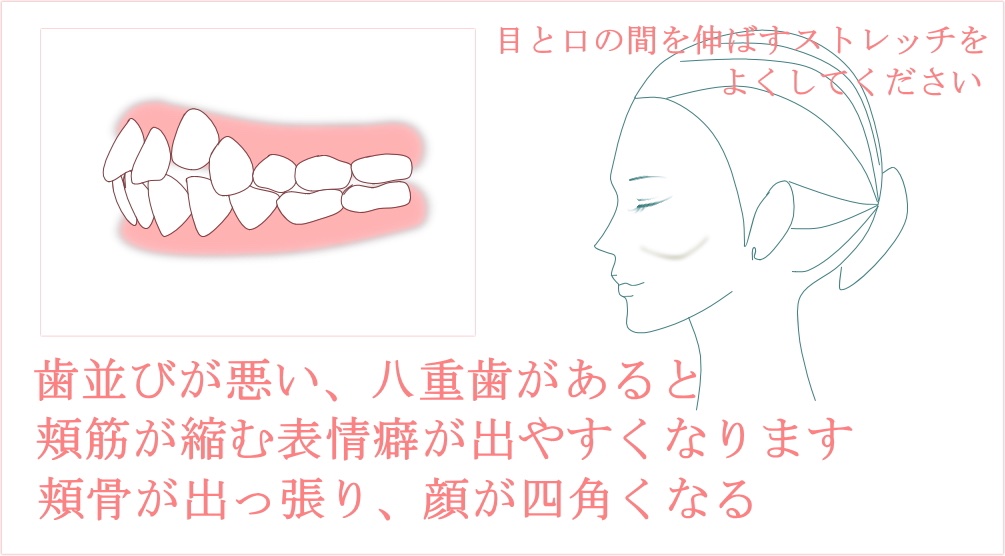 歯並び悪い 歯並び悪い