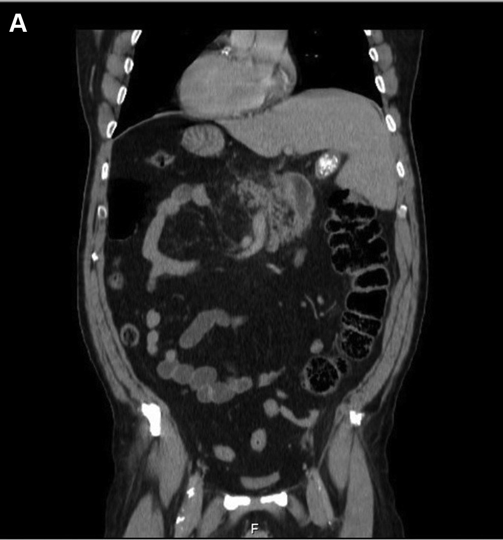 Gastroenterology tweet media