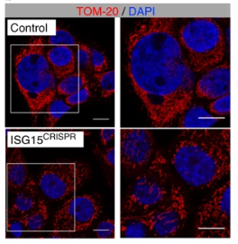 NatureComms's tweet image. Post-translational ISGylation regulates mitochondrial function to allow cancer-stem cell self-renewal in pancreatic cancer.

go.nature.com/3eErs0U

#CancerResearch
@IIBmCSICUAM @UAM_Madrid @pdac_aecc