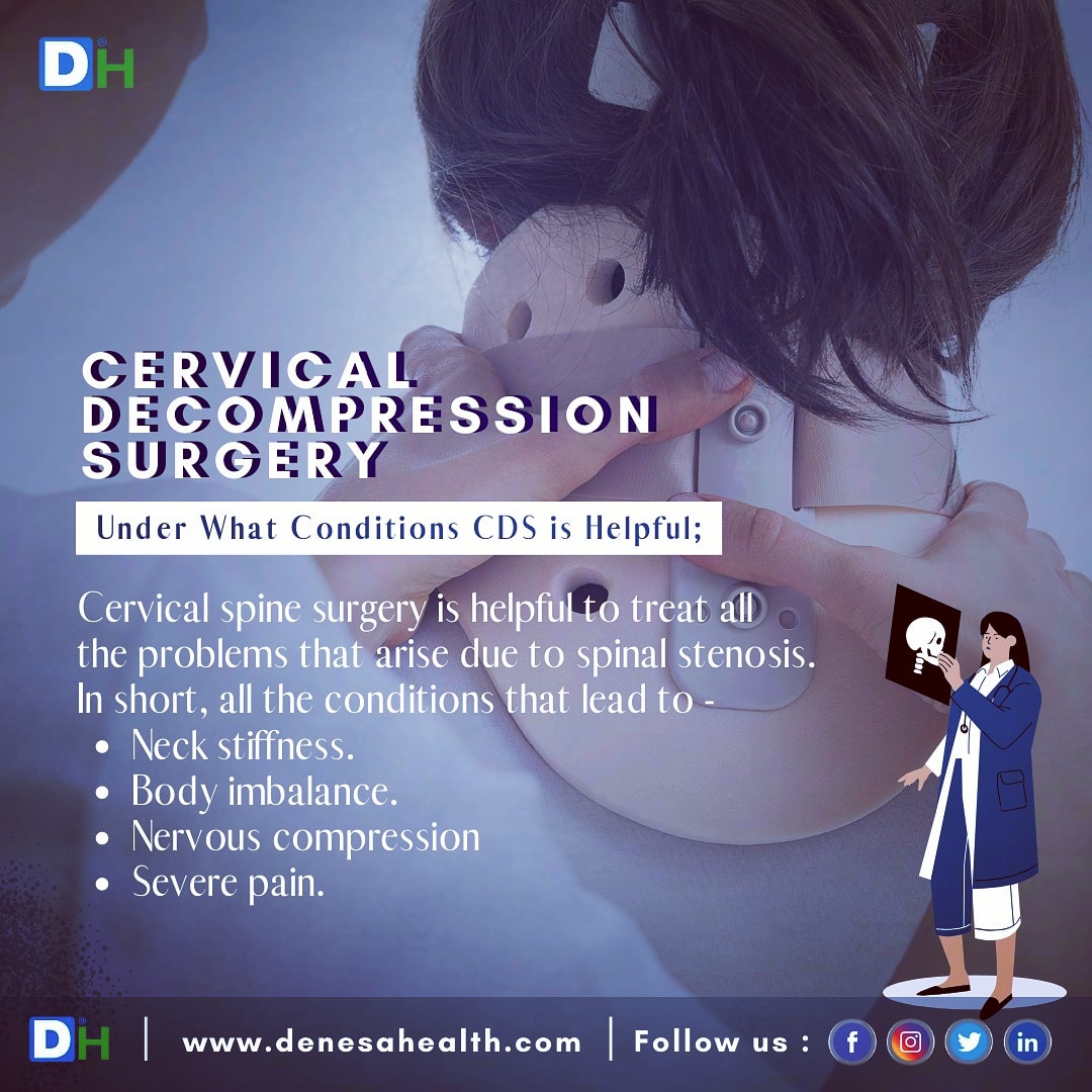 DenesaHealth's tweet photo. Conditions for #CervicalDecompression Surgery;
The most common situation that calls for #CervicalDecompressionsurgery is cervical #spinalstenosis. Check out conditions; https://t.co/rpQMJF3iRR
#CervicalPain #SpinalCordIssues #DecompressionSurgery #NeckStiffness #DenesaHealth https://t.co/mJZxG6iXza